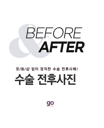 전후사례