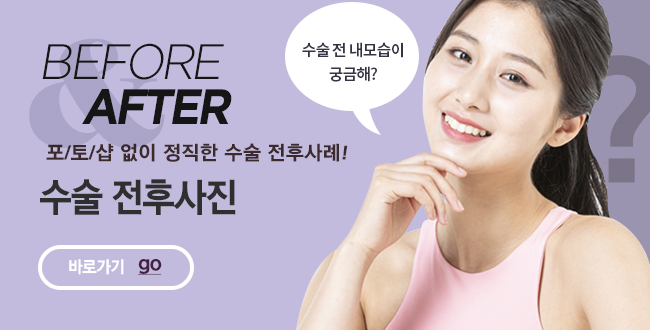전후사례